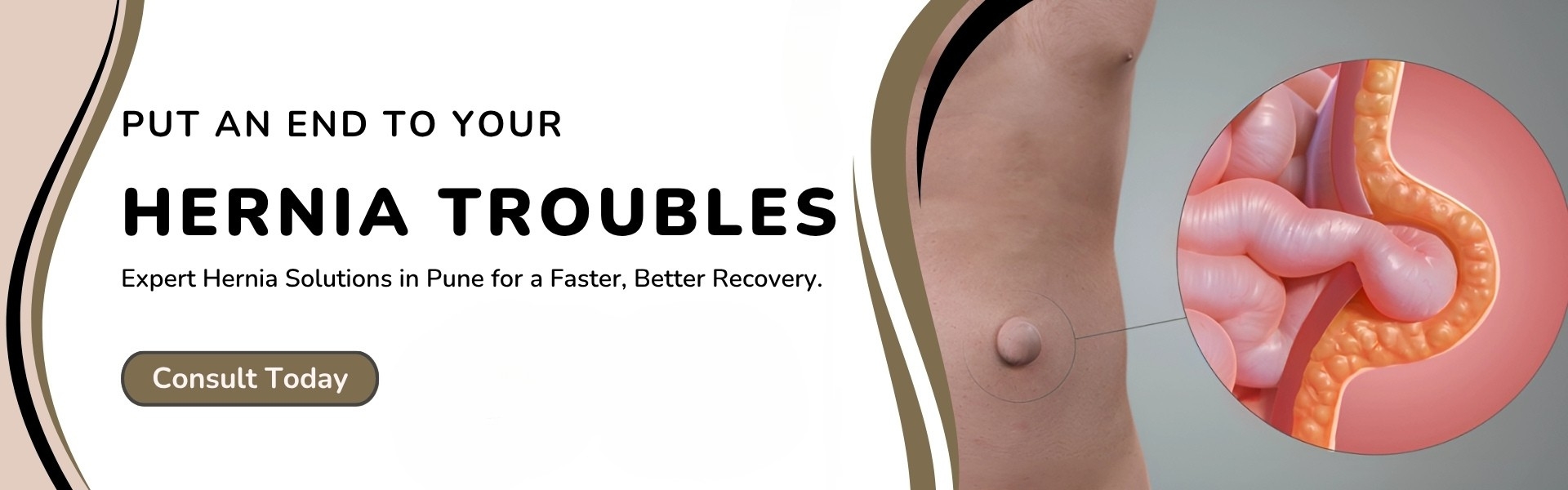 hernia-banner